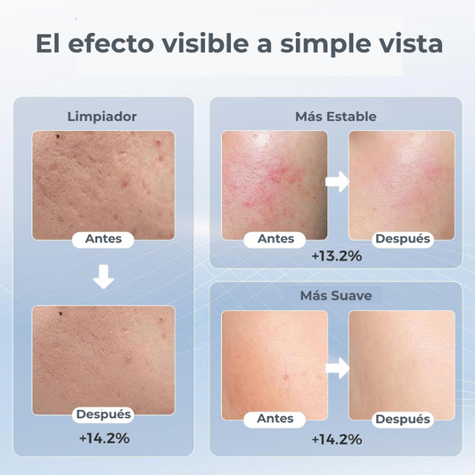Máscara facial LED con terapia de luz roja para La cara y la piel